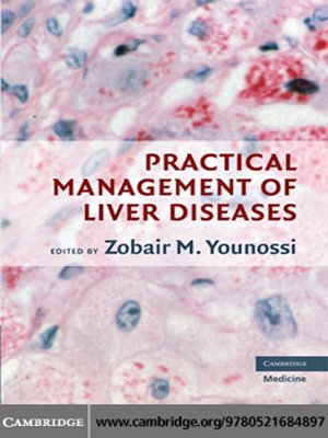 cover image of Practical Management of Liver Diseases